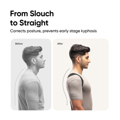 Dilomart Orthotics Posture Corrector